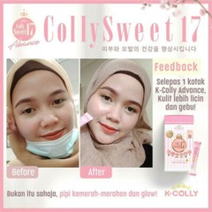 K-COLLY SWEET17 Korean Nano Collagen Advance Triple Whitening 20’s FREE BOOSTER