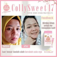 K-COLLY SWEET17 Korean Nano Collagen Advance Triple Whitening 20’s FREE BOOSTER