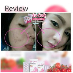 5 x SOQ Gluta Collagen 10000mg Bright Whitening Skin Reduces Dark Spots Freckles