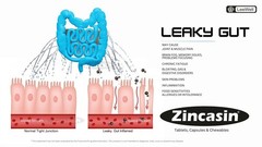 Zincasin Zinc L-Carnosine 75mg x60 | Gut, Immunity, Skin, Hair, Ulcer & IBS Supp