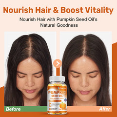 3 Packs Pumpkin Seed Oil Saw Palmetto Softgels – Natural Prostate Support